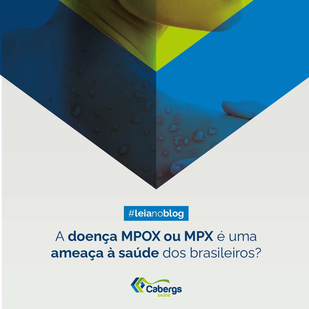 A doença MPOX ou MPX é uma ameaça à saúde dos brasileiros?